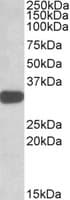 IHC-plus™ Polyclonal Goat anti-Human TIPRL / TIP Antibody (aa257-270, IHC, WB)