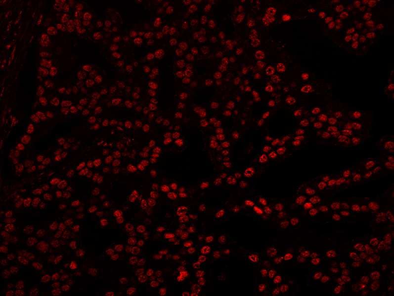 IHC-plus™ Polyclonal Rabbit anti-Human XRN2 Antibody (aa900-950, IHC, IF)