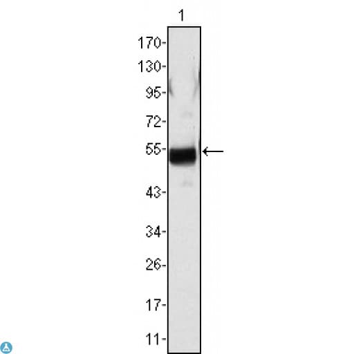 Monoclonal Mouse anti-Human FGB / Fibrinogen Beta Chain Antibody (WB)