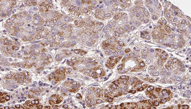 Polyclonal Rabbit anti-Human ADGRL4 / ELTD1 Antibody (IHC, WB)