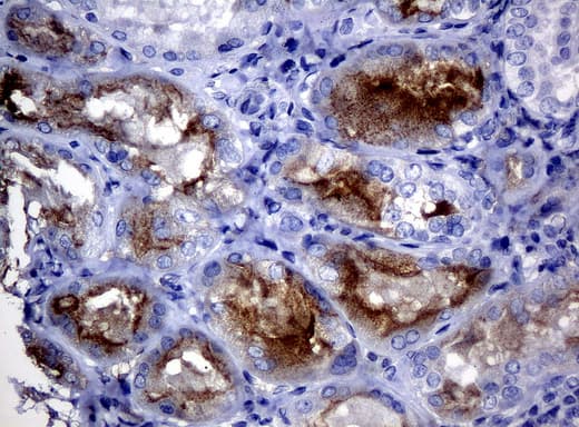 FOLH1 / PSMA Antibody (clone UMAB27, Carrier-free)
