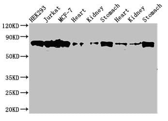 PRKCH / PKC-Eta Antibody