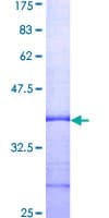 Human COL6A1 / Collagen VI Alpha 1 Protein (Recombinant GST, N-terminus)