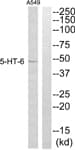 Polyclonal Rabbit anti-Human HTR6 / 5-HT6 Receptor Antibody (WB)