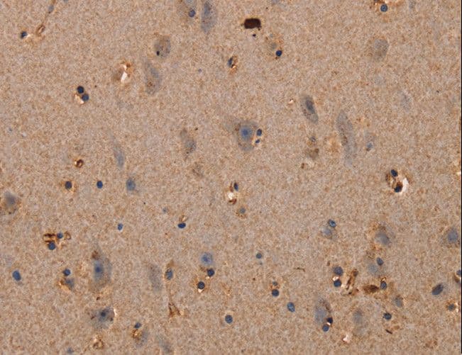 PLXNA1 / Plexin A1 Antibody