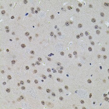 SET / TAF-I Antibody