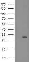 15-PGDH / HPGD Antibody (clone OTI2C10)