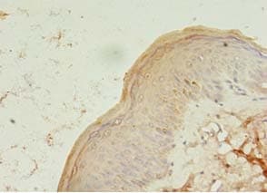Polyclonal Rabbit anti-Human TCHP Antibody (IHC)