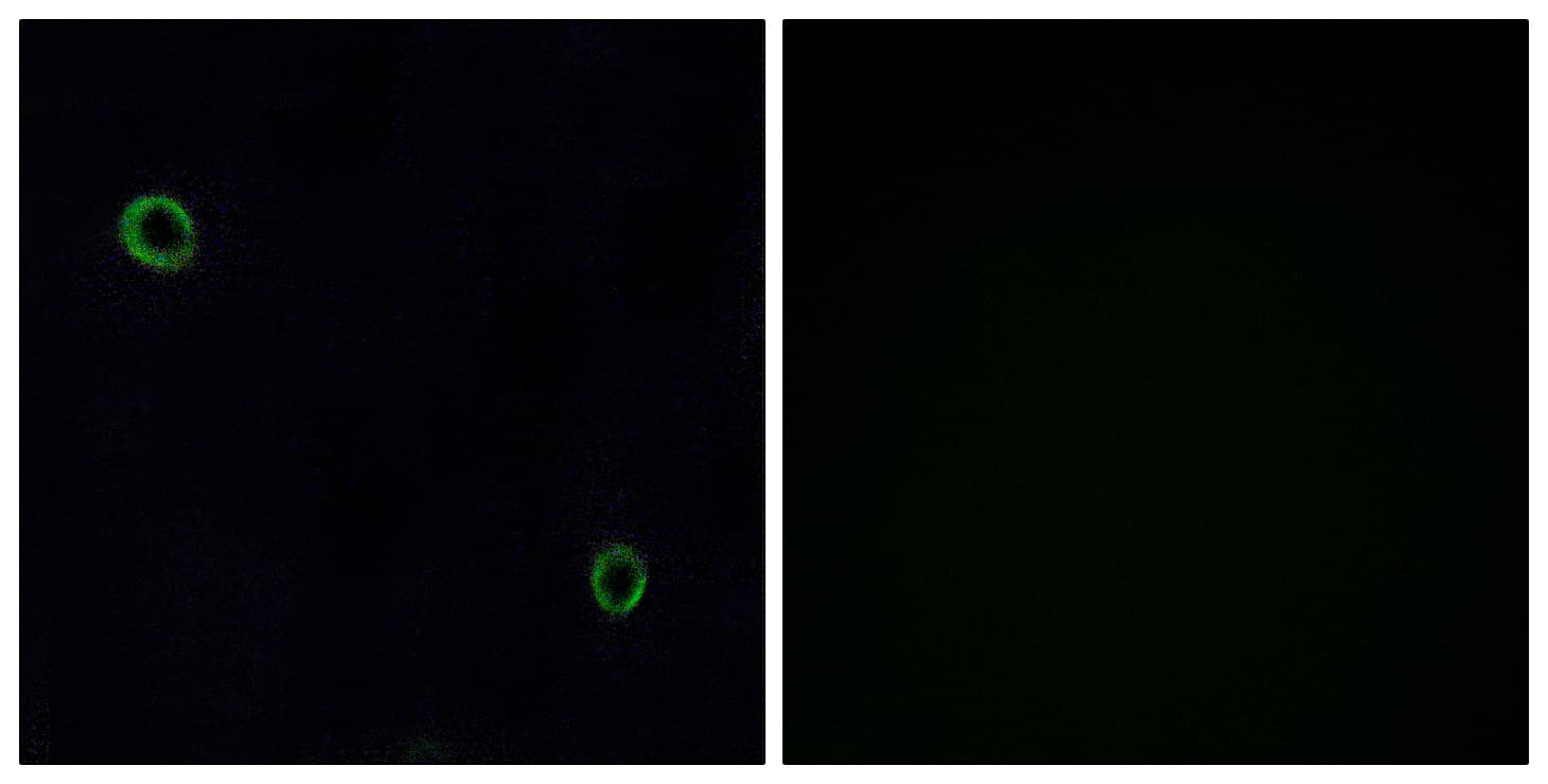 IHC-plus™ Polyclonal Rabbit anti-Human CXCR4 Antibody (aa300-349, IHC, IF, WB)