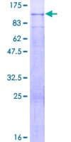 Human PODN Protein (Recombinant GST)