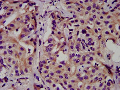 CEAL2 / CEACAM16 Antibody