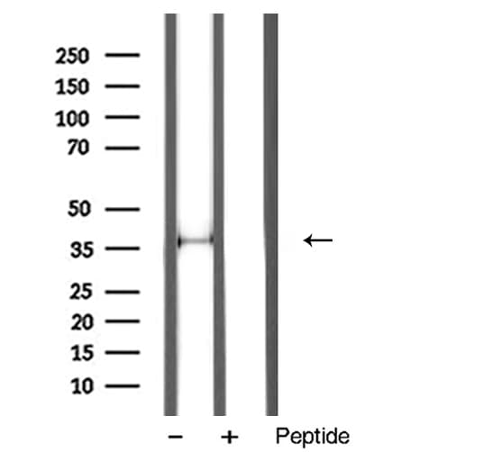 Polyclonal Rabbit anti-Human ANXA1 / Annexin A1 Antibody (IHC, WB)