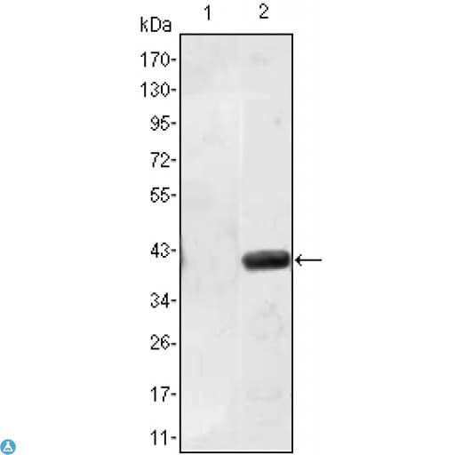 MATN1 / Matrilin 1 Antibody