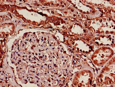 14-3-3 Alpha + Beta Antibody