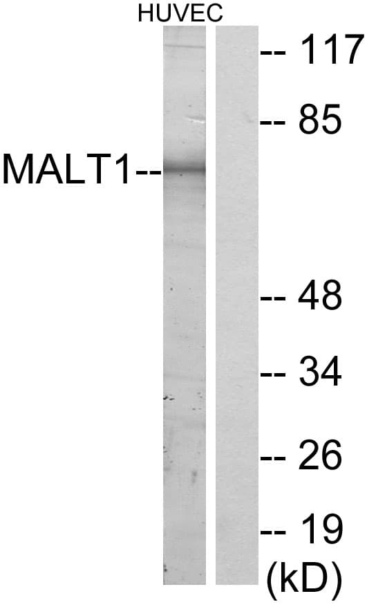 MALT1 Antibody (aa301-350)