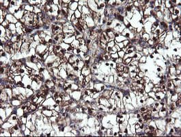 Monoclonal Mouse anti-Human Mannose Phosphate Isomerase Antibody (clone OTI1C7, Carrier-free, IHC, IF, WB)