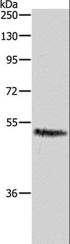 CASP2 / Caspase 2 Antibody