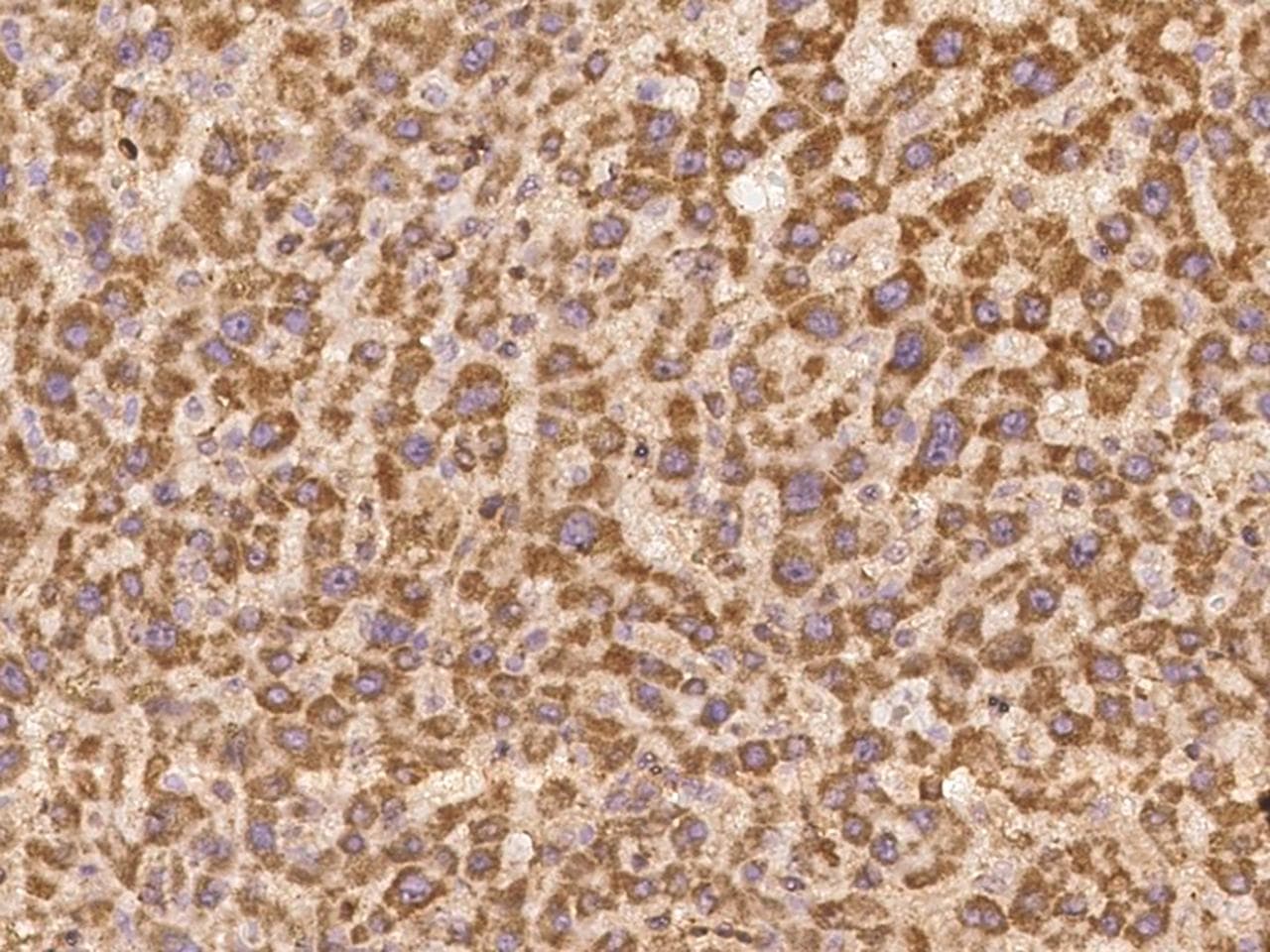 LYPD2 Antibody