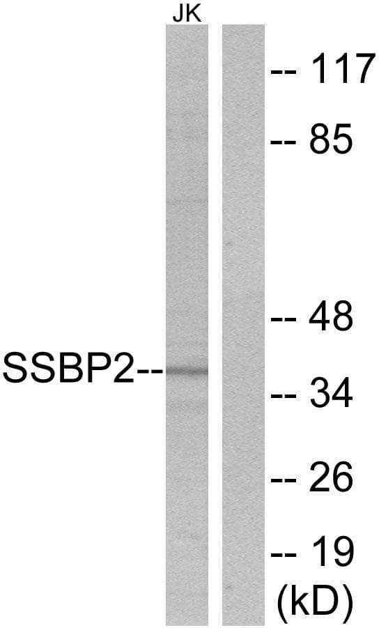 Polyclonal Rabbit anti-Human SSBP2 Antibody (IHC, WB)
