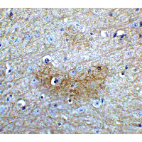 Polyclonal Rabbit anti-Human GLS2 / Glutaminase 2 Antibody (IHC, IF, WB)