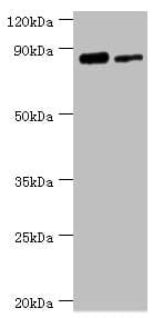 ERCC2 / XPD Antibody (aa1-300)