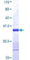 Human IGF2BP2 Protein (Recombinant GST, N-terminus)