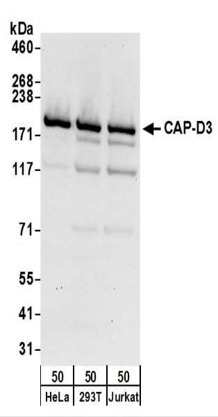 Polyclonal Rabbit anti-Human NCAPD3 / HCAP-D3 Antibody (aa1450-C-term, WB)