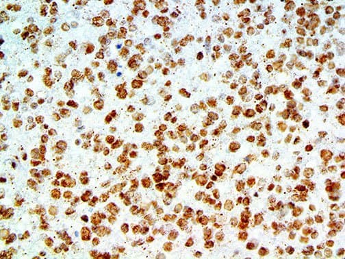 APP / Beta Amyloid Precursor Antibody (clone RBT-A4)