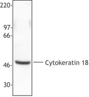 IHC-plus™ KRT18 / CK18 / Cytokeratin 18 Antibody (C-Terminus)