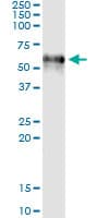 F9 / Factor IX Antibody (clone 2C9)