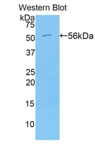 ACE / CD143 Antibody (aa504-597, Cy3)