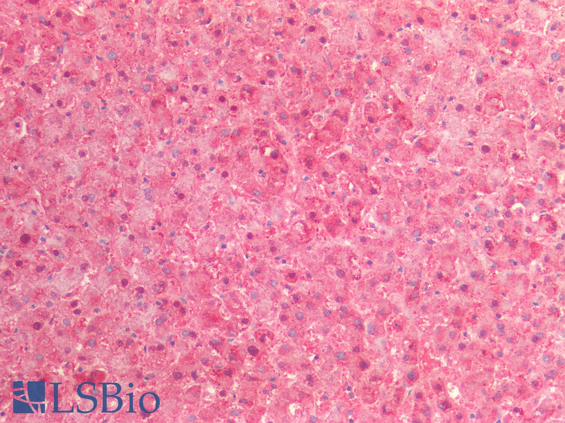 PathPlus™ Polyclonal Rabbit anti-Human RAB7A / RAB7 Antibody (IHC)