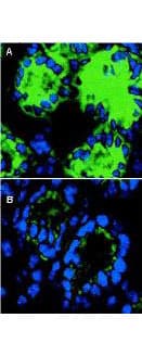 Polyclonal Rabbit anti-Mouse IL18 Antibody (IHC, IF, WB)