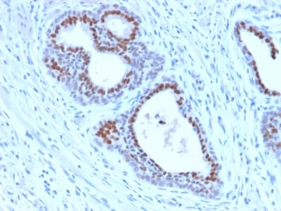 FOXA1 Antibody (aa372-472, clone FOXA1/2230R)