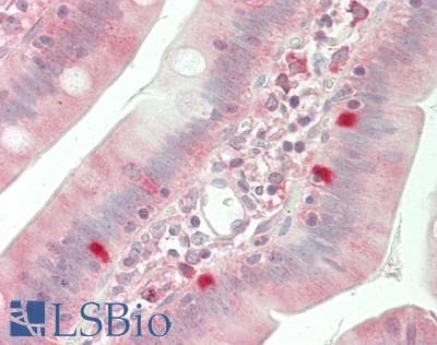 IHC-plus™ Polyclonal Rabbit anti-Human FHIT Antibody (aa80-129, IHC)