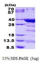 Human NRIP3 Protein (Recombinant His)
