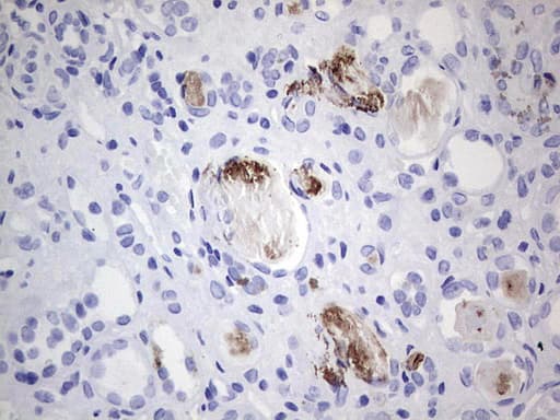 MMP7 / Matrilysin Antibody (aa95-267, clone OTI4H8)