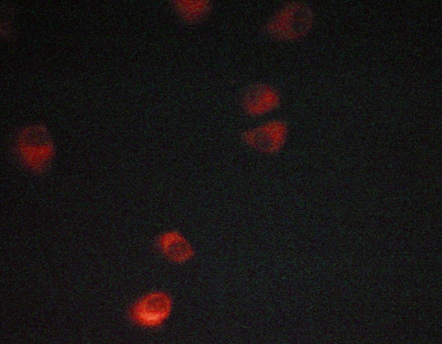 SYK Antibody