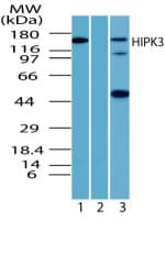 IHC-plus™ HIPK3 / FIST Antibody (aa850-900)