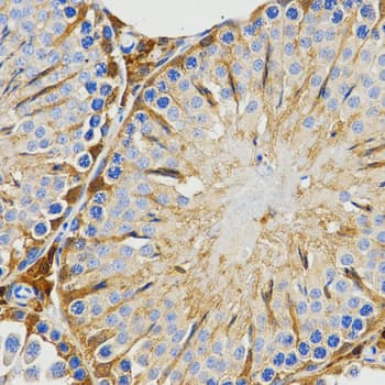IHC-plus™ HIWI2 / PIWIL4 Antibody
