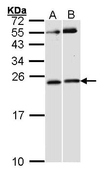 RAC1 Antibody (aa1-196)
