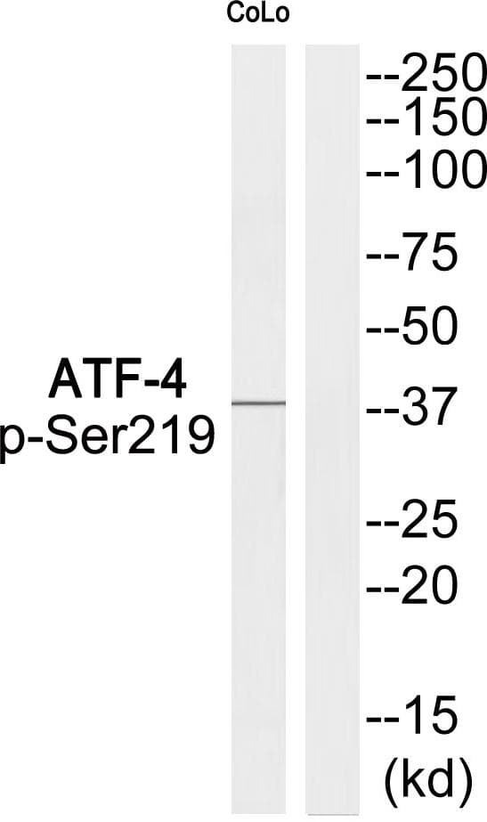 ATF4 Antibody (phospho-Ser219)