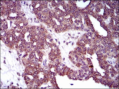 Monoclonal Mouse anti-Human DNM1L / DRP1 Antibody (clone 4E11B11, aa69-213, IHC, WB)