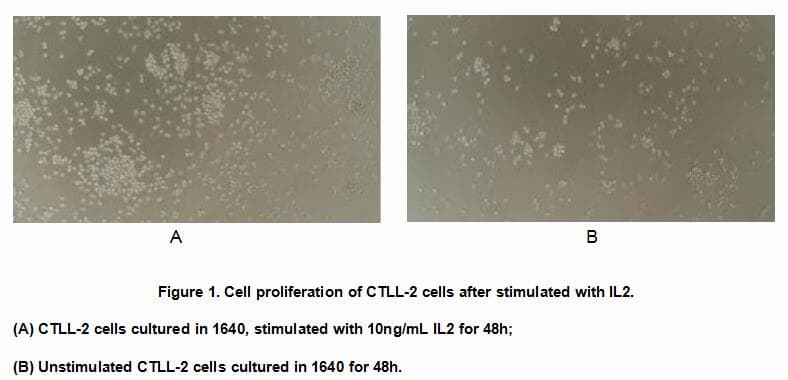 Human CCL3 / MIP-1-Alpha Protein (Recombinant His, N-Terminal)