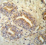 CWC15 Antibody (aa123-152)