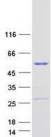 Human DENND1B Protein (Recombinant Myc-DDK (Flag))