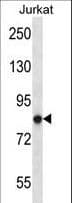 IHC-plus™ PRKCA / PKC-Alpha Antibody (aa1-30)