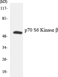 RPS6KB2 / S6K2 Antibody (aa368-417)