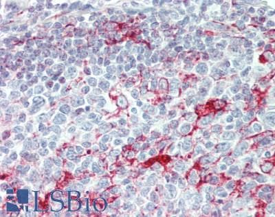 IHC-plus™ AGPAT9 / MAG1 Antibody
