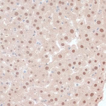 Polyclonal Rabbit anti-Human ZNF562 Antibody (IHC)